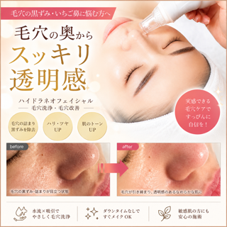 coupon photo