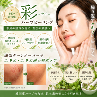 coupon photo