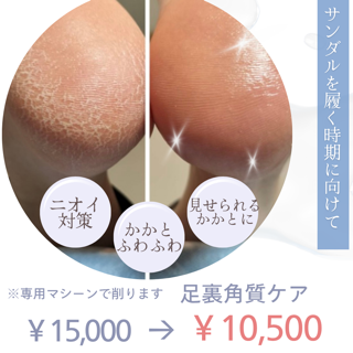 coupon photo