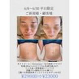 coupon photo