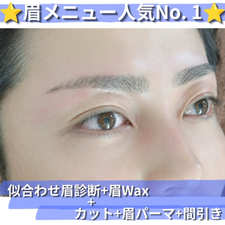 coupon photo