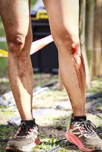 BIB: 
                            <button type="button" onclick="openModal(18965780)" class="btn btn-primary btn-sm float-right btn-popup" data-toggle="modal" data-target=".modal-high-quality">
                        <i class="fas fa-shopping-cart"></i> Add to Cart
                    </button>
                                            <button type="button" onclick="isThisMe(18965780, true)" class="btn btn-success btn-sm float-right btn-popup btn-isme hidden" data-toggle="tooltip" data-placement="bottom" title="นี่คือรูปของคุณใช่ไหม คลิกที่นี่เพื่อเอาเข้าอัลบั้ม">
                        <i class="fas fa-plus"></i> Add to album
                    </button>
                    <button type="button" onclick="isThisMe(18965780, false)" class="btn btn-warning btn-sm float-right btn-popup btn-isnotme hidden">
                        <i class="fas fa-ban"></i> Remove from album
                    </button>