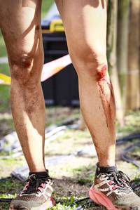 BIB: 
                            <button type="button" onclick="openModal(18965781)" class="btn btn-primary btn-sm float-right btn-popup" data-toggle="modal" data-target=".modal-high-quality">
                        <i class="fas fa-shopping-cart"></i> Add to Cart
                    </button>
                                            <button type="button" onclick="isThisMe(18965781, true)" class="btn btn-success btn-sm float-right btn-popup btn-isme hidden" data-toggle="tooltip" data-placement="bottom" title="นี่คือรูปของคุณใช่ไหม คลิกที่นี่เพื่อเอาเข้าอัลบั้ม">
                        <i class="fas fa-plus"></i> Add to album
                    </button>
                    <button type="button" onclick="isThisMe(18965781, false)" class="btn btn-warning btn-sm float-right btn-popup btn-isnotme hidden">
                        <i class="fas fa-ban"></i> Remove from album
                    </button>