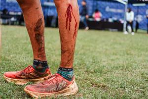 BIB: 
                            <button type="button" onclick="openModal(25044874)" class="btn btn-primary btn-sm float-right btn-popup" data-toggle="modal" data-target=".modal-high-quality">
                        <i class="fas fa-shopping-cart"></i> Add to Cart
                    </button>
                                            <button type="button" onclick="isThisMe(25044874, true)" class="btn btn-success btn-sm float-right btn-popup btn-isme hidden" data-toggle="tooltip" data-placement="bottom" title="นี่คือรูปของคุณใช่ไหม คลิกที่นี่เพื่อเอาเข้าอัลบั้ม">
                        <i class="fas fa-plus"></i> Add to album
                    </button>
                    <button type="button" onclick="isThisMe(25044874, false)" class="btn btn-warning btn-sm float-right btn-popup btn-isnotme hidden">
                        <i class="fas fa-ban"></i> Remove from album
                    </button>