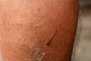 BIB: 
                            <button type="button" onclick="openModal(25044317)" class="btn btn-primary btn-sm float-right btn-popup" data-toggle="modal" data-target=".modal-high-quality">
                        <i class="fas fa-shopping-cart"></i> Add to Cart
                    </button>
                                            <button type="button" onclick="isThisMe(25044317, true)" class="btn btn-success btn-sm float-right btn-popup btn-isme hidden" data-toggle="tooltip" data-placement="bottom" title="นี่คือรูปของคุณใช่ไหม คลิกที่นี่เพื่อเอาเข้าอัลบั้ม">
                        <i class="fas fa-plus"></i> Add to album
                    </button>
                    <button type="button" onclick="isThisMe(25044317, false)" class="btn btn-warning btn-sm float-right btn-popup btn-isnotme hidden">
                        <i class="fas fa-ban"></i> Remove from album
                    </button>