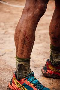 BIB: 
                            <button type="button" onclick="openModal(25211998)" class="btn btn-primary btn-sm float-right btn-popup" data-toggle="modal" data-target=".modal-high-quality">
                        <i class="fas fa-shopping-cart"></i> Add to Cart
                    </button>
                                            <button type="button" onclick="isThisMe(25211998, true)" class="btn btn-success btn-sm float-right btn-popup btn-isme hidden" data-toggle="tooltip" data-placement="bottom" title="นี่คือรูปของคุณใช่ไหม คลิกที่นี่เพื่อเอาเข้าอัลบั้ม">
                        <i class="fas fa-plus"></i> Add to album
                    </button>
                    <button type="button" onclick="isThisMe(25211998, false)" class="btn btn-warning btn-sm float-right btn-popup btn-isnotme hidden">
                        <i class="fas fa-ban"></i> Remove from album
                    </button>