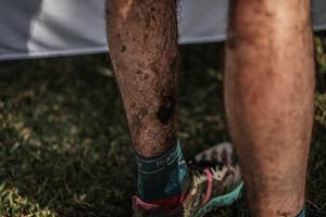 BIB: 
                            <button type="button" onclick="openModal(16060702)" class="btn btn-primary btn-sm float-right btn-popup" data-toggle="modal" data-target=".modal-high-quality">
                        <i class="fas fa-shopping-cart"></i> Add to Cart
                    </button>
                                            <button type="button" onclick="isThisMe(16060702, true)" class="btn btn-success btn-sm float-right btn-popup btn-isme hidden" data-toggle="tooltip" data-placement="bottom" title="นี่คือรูปของคุณใช่ไหม คลิกที่นี่เพื่อเอาเข้าอัลบั้ม">
                        <i class="fas fa-plus"></i> Add to album
                    </button>
                    <button type="button" onclick="isThisMe(16060702, false)" class="btn btn-warning btn-sm float-right btn-popup btn-isnotme hidden">
                        <i class="fas fa-ban"></i> Remove from album
                    </button>