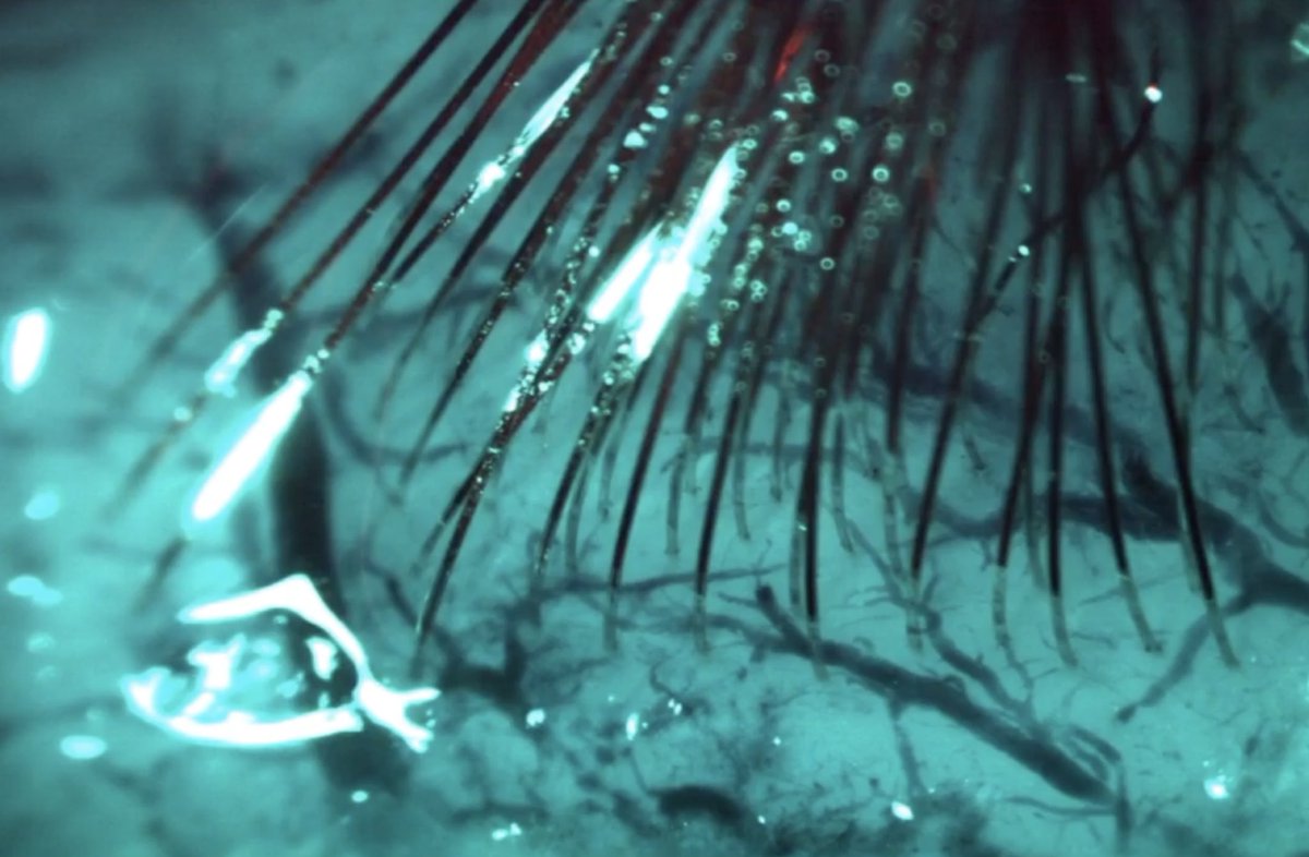   ・髪の毛より細い電極1024本を脳に埋め込む ・それらの電極で脳波を記録する ・電極で脳を直接刺激することもできる ・これらをiPhoneのアプリ上で操作できる ・来年(!)にヒトでの臨床試験を開始する 