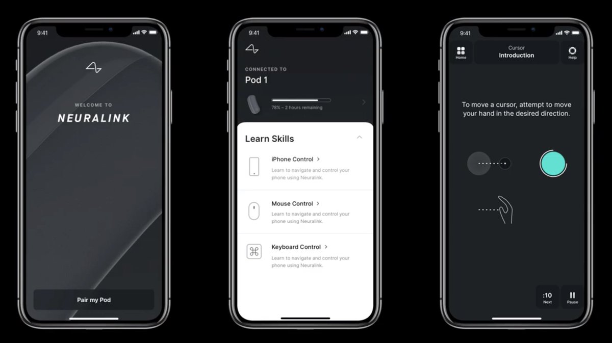  ・髪の毛より細い電極1024本を脳に埋め込む ・それらの電極で脳波を記録する ・電極で脳を直接刺激することもできる ・これらをiPhoneのアプリ上で操作できる ・来年(!)にヒトでの臨床試験を開始する 