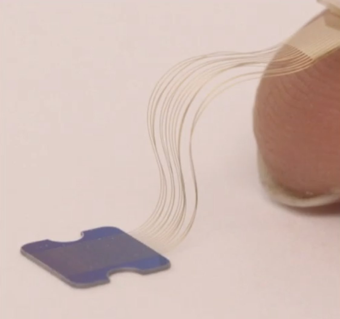   ・髪の毛より細い電極1024本を脳に埋め込む ・それらの電極で脳波を記録する ・電極で脳を直接刺激することもできる ・これらをiPhoneのアプリ上で操作できる ・来年(!)にヒトでの臨床試験を開始する 