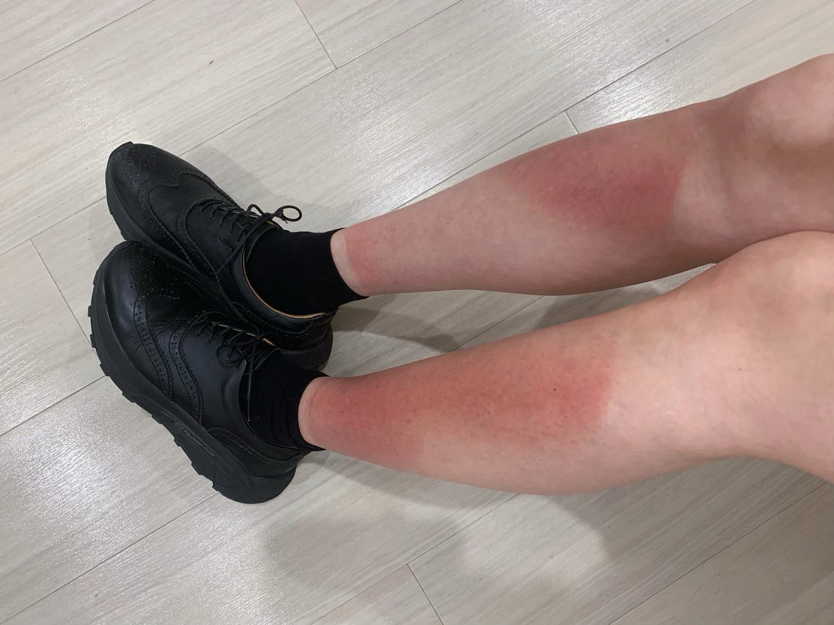傷痕が残ってしまうかもしれないし、同じ事が起こらないよう気をつけてほしいです