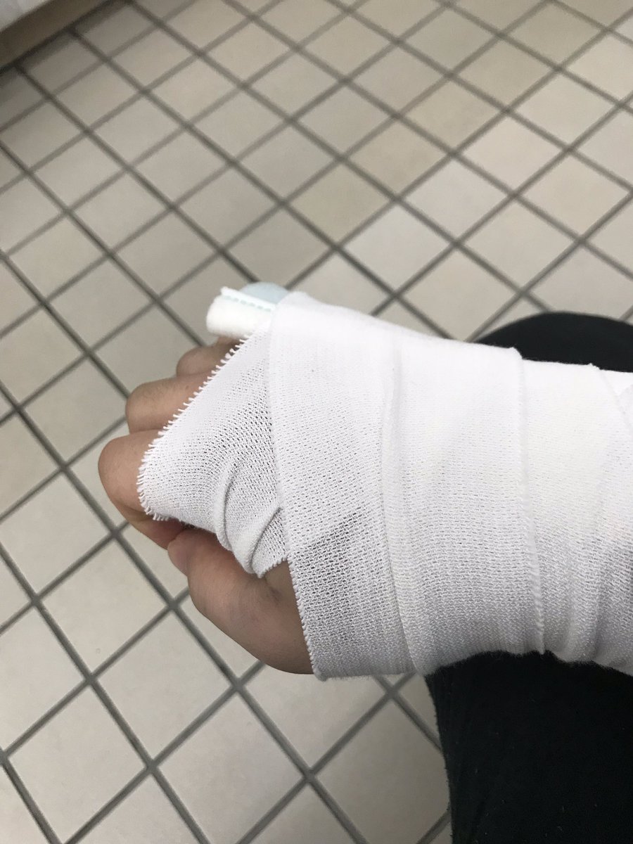  漫画家として一番やってはいけない事をやらかしてしまいました……  右手首骨折、全治2〜3ヶ月らしいです 