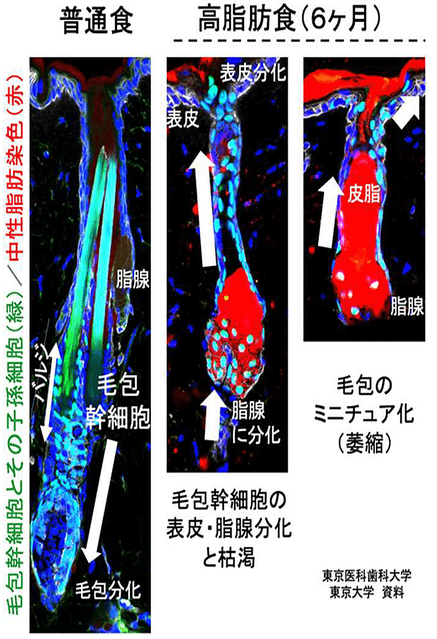 研究で解明   東大などの研究チームがマウスの実験で薄毛・脱毛を促進するメカニズムを解明したと発表