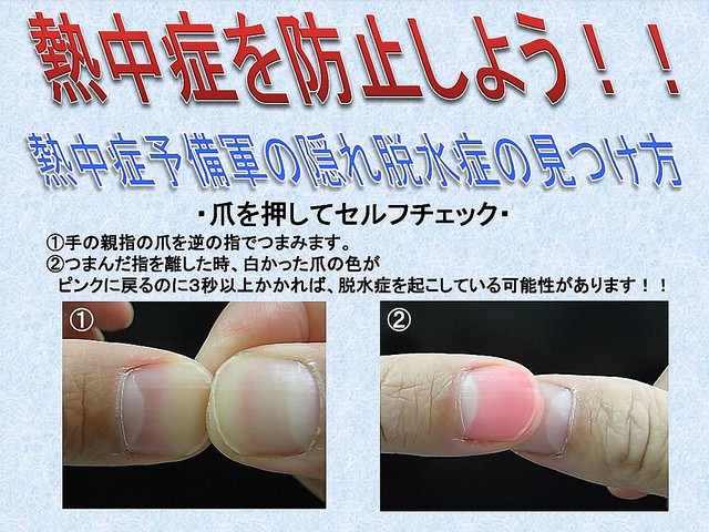 また、尿の色でも体内の水分が足りているかをチェックできるという