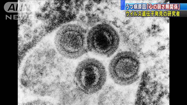 【研究】うつ病の原因「心の弱さは無関係」専門家 慈恵医科大の教授らは今年、ほぼ全員が感染しているウイルスの遺伝子が原因となるたんぱく質を作っていると発表