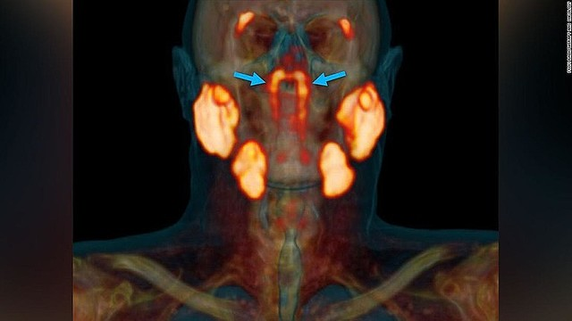 唾液腺の一部ではなく、解剖学的にも機能的にも新しい器官だという