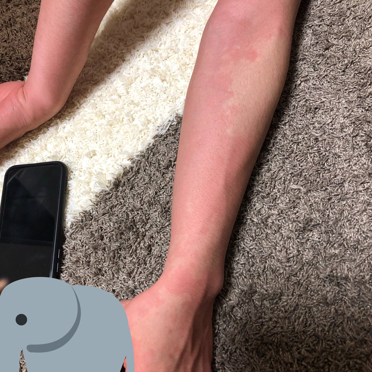 昨晩 『ちーずやお』が緊急入院し、今朝方退院されました 担当医は『今まで何人もの患者を診てきたが消毒用エタノールを飲んで運ばれた奴なんて聞いたことがない』とのことです 重課金を繰り返す皆様も、いつ何時私のような状況になるかわからないので、この場を借りて注意喚起とさせていただきます