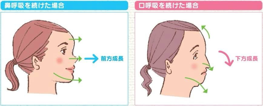 悪いことは言わないから鼻呼吸して 