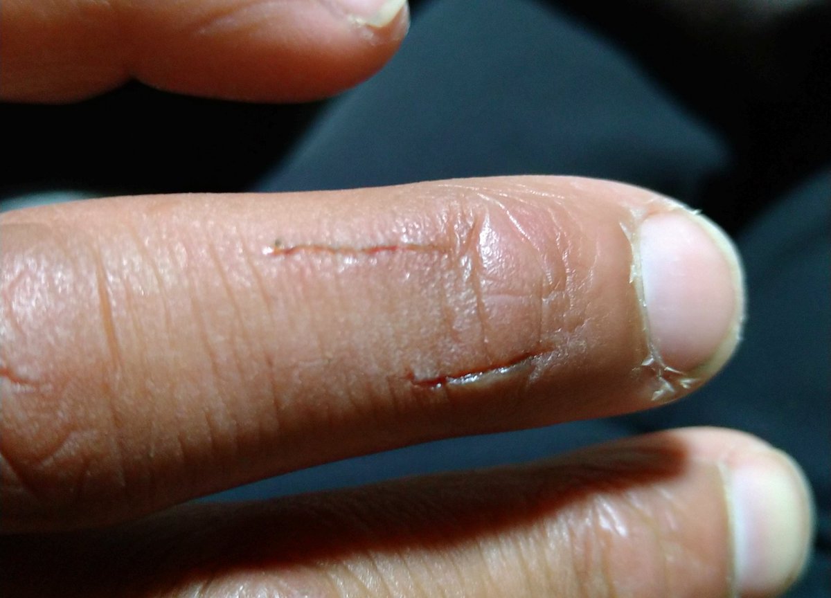 それを飼育員は全力で止めようとする 確かに喜怒哀楽が分かりやすく可愛いかもしれないけど調教されていない鯨類がどんなに恐ろしいかも知ってほしい  ※今回は噛まれただけでよかった 