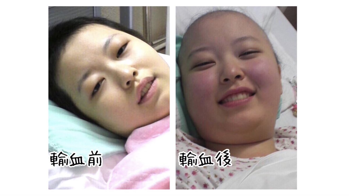 わたしは100回以上の輸血のおかげで助かりました