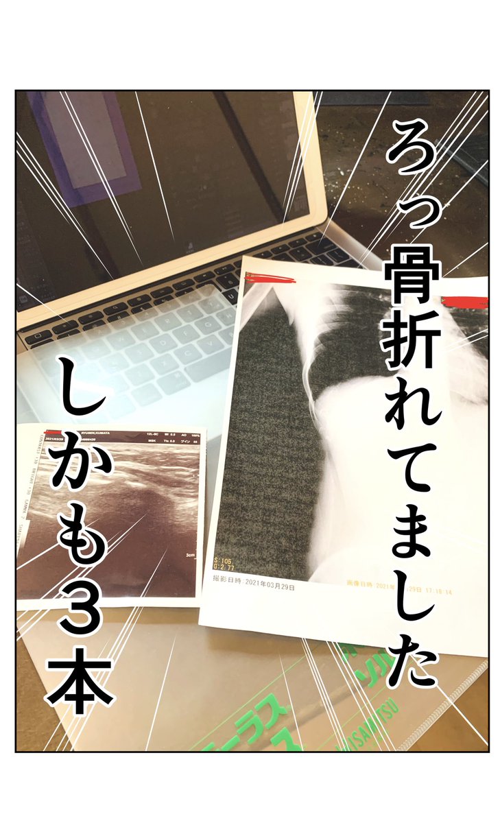 何もしてないのに骨折った話(ルポ漫画) 