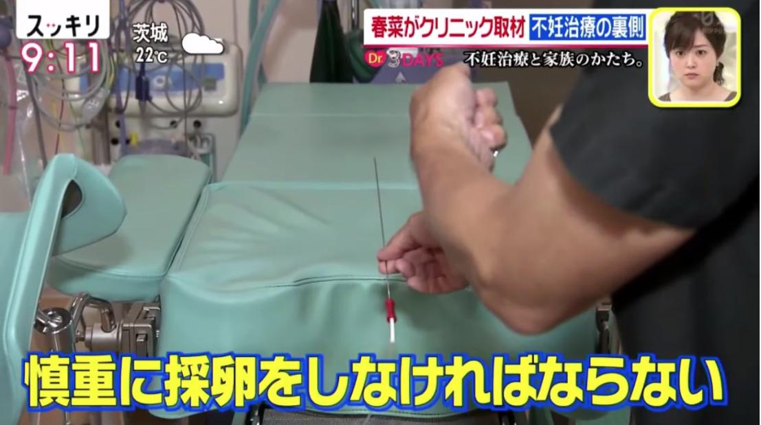 採卵針を見た春菜ちゃん ・意外と軽い、ただ自分に入ってくると思ったらだいぶ尖っているし針感がスゴイ  #スッキリ #不妊治療 ------ 針の長さは約30cm  世の旦那さん...見てますか...これが膣の中に入ってくるのですよ... 世の上司達...見てますか...これを刺した後会社に駆けつけているのですよ... 