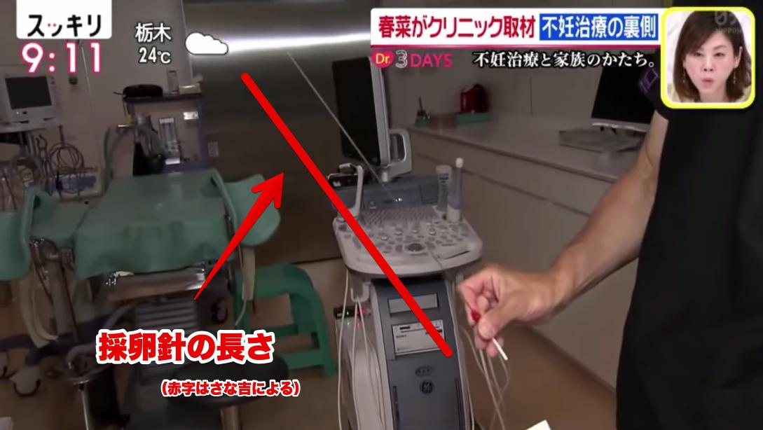 採卵針を見た春菜ちゃん ・意外と軽い、ただ自分に入ってくると思ったらだいぶ尖っているし針感がスゴイ  #スッキリ #不妊治療 ------ 針の長さは約30cm  世の旦那さん...見てますか...これが膣の中に入ってくるのですよ... 世の上司達...見てますか...これを刺した後会社に駆けつけているのですよ... 