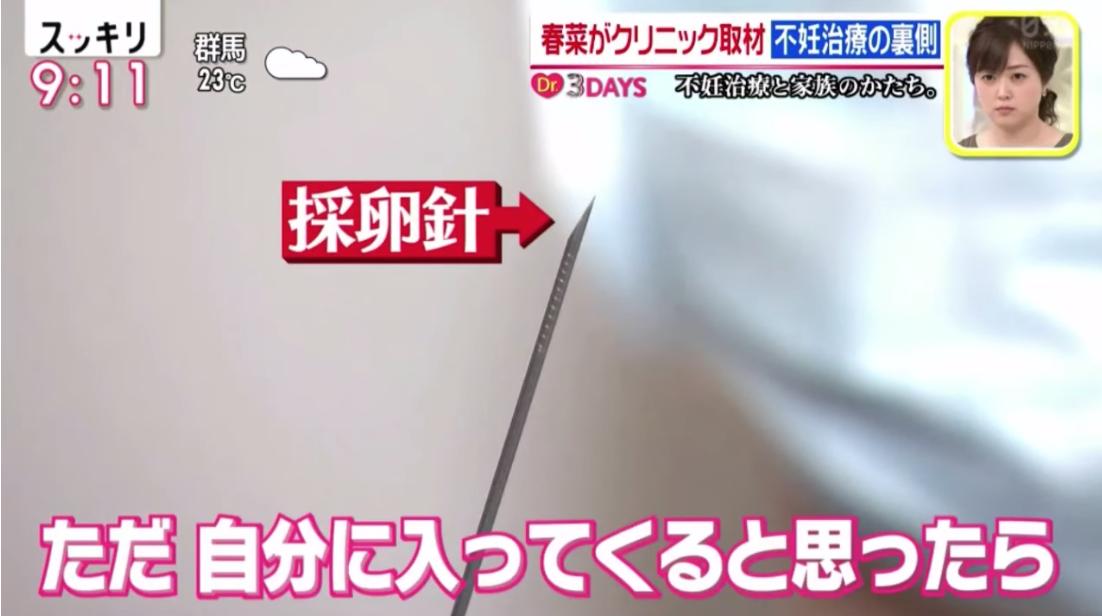 採卵針を見た春菜ちゃん ・意外と軽い、ただ自分に入ってくると思ったらだいぶ尖っているし針感がスゴイ  #スッキリ #不妊治療 ------ 針の長さは約30cm  世の旦那さん...見てますか...これが膣の中に入ってくるのですよ... 世の上司達...見てますか...これを刺した後会社に駆けつけているのですよ... 