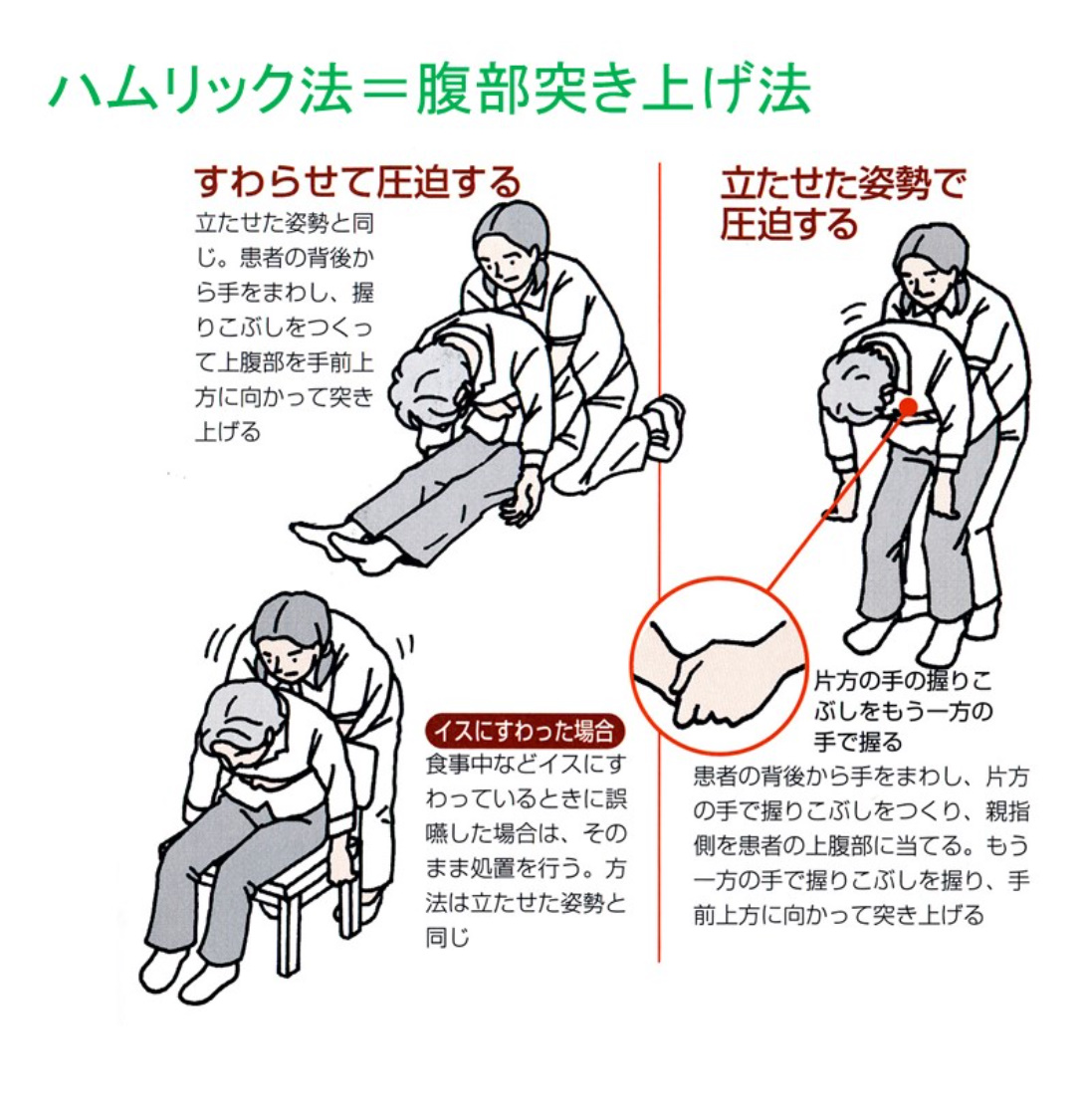 お正月だからこそ知っておきたい「腹部突き上げ法」と「背中叩打法」です