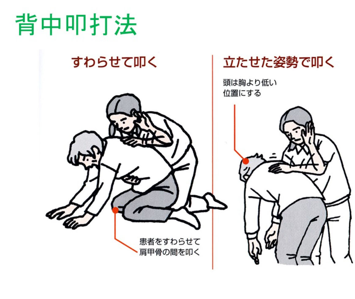 お正月だからこそ知っておきたい「腹部突き上げ法」と「背中叩打法」です