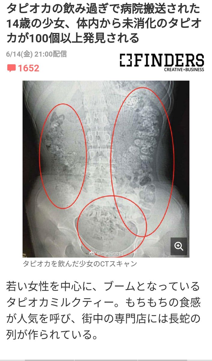 タピオカの飲み過ぎも気をつけなよー 