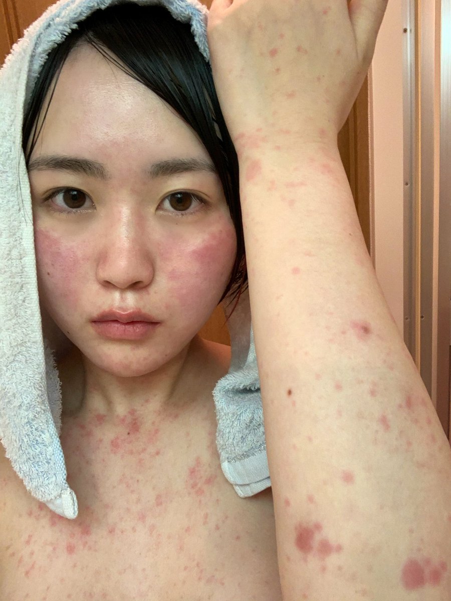 とりあえず顔だけ治ればいいから…