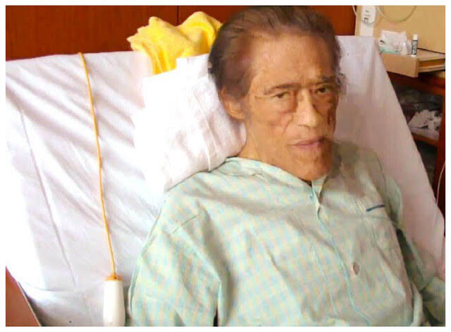 アントニオ猪木の生命力が凄すぎる 左が数か月前　　　右が現在 