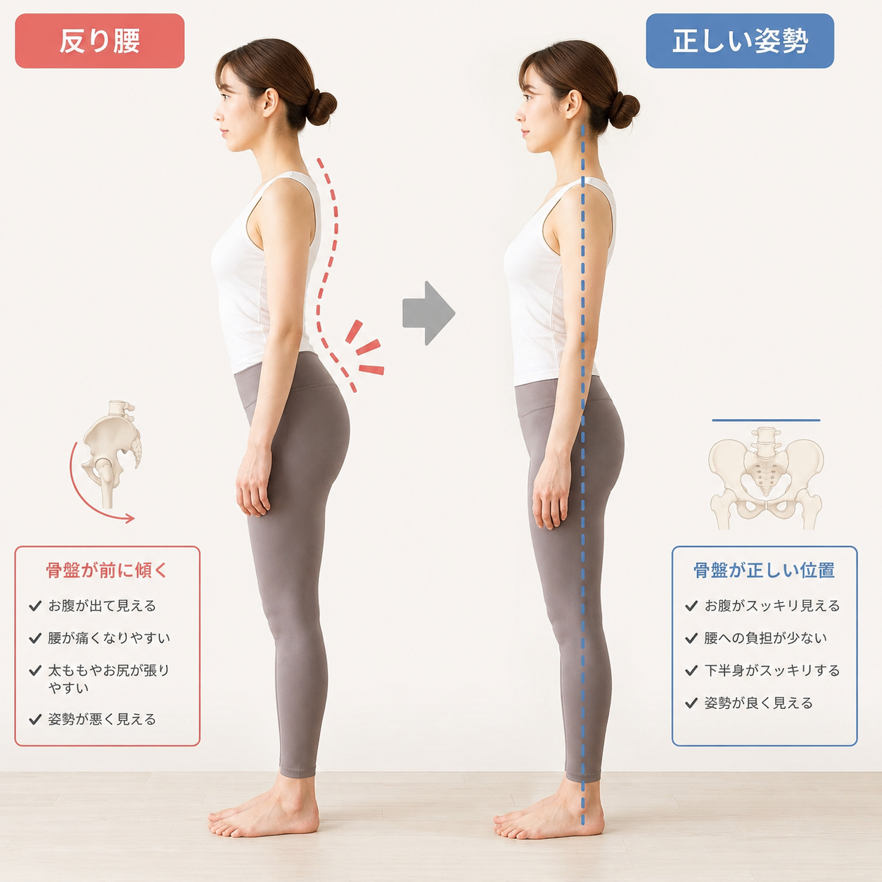 太宰府市在住　E様の腰痛・反り腰が改善いたしました。