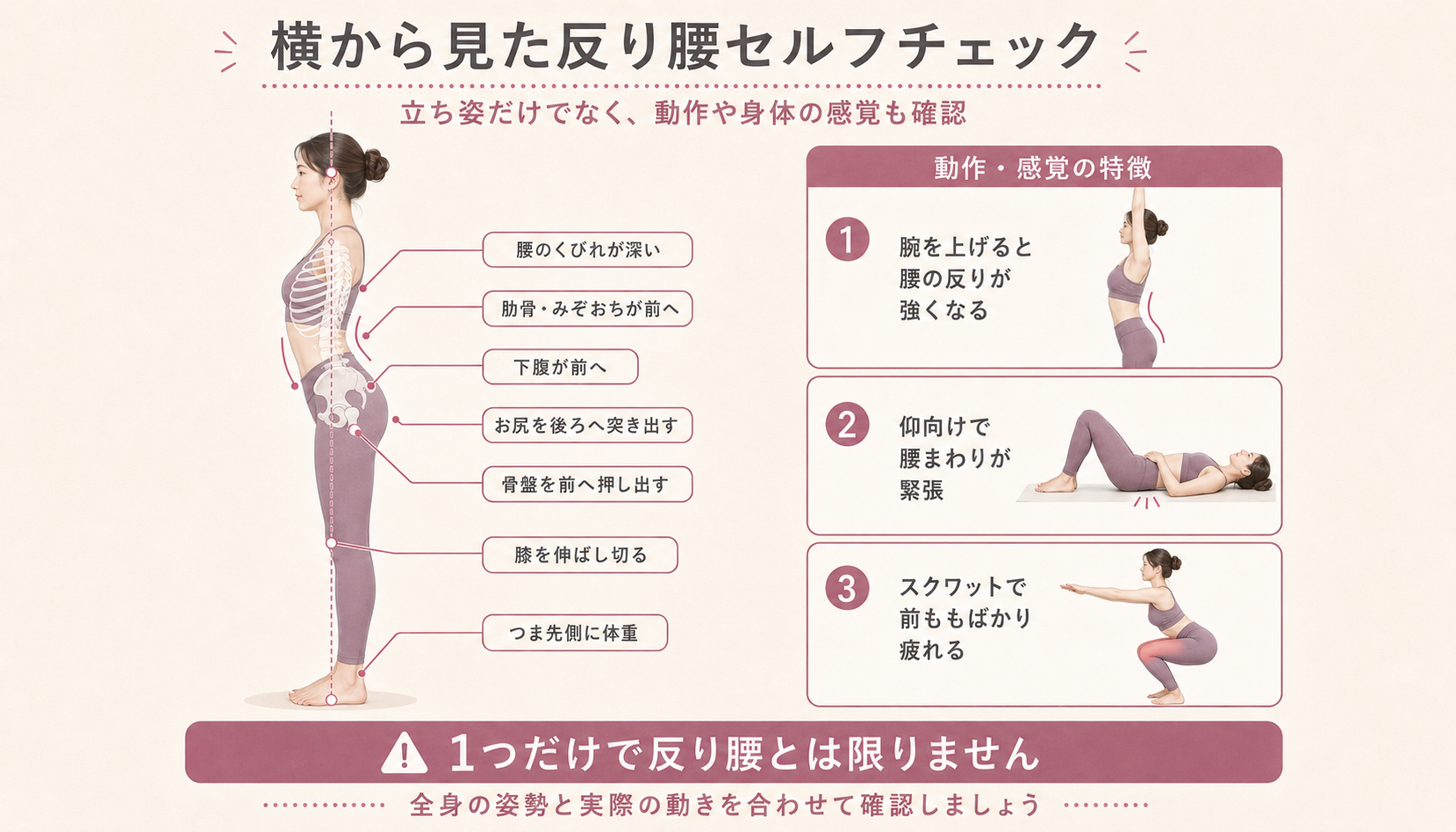 横から見た女性の姿勢に現れやすい7つの特徴と、腕上げ・仰向け・スクワット時に現れやすい反り腰の特徴を示した図解