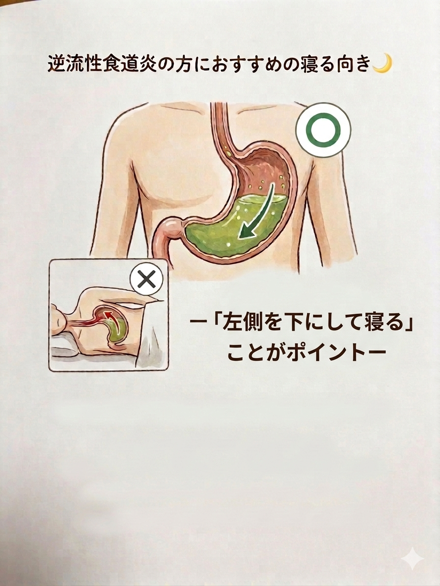 【ととのえ日記128】  逆流性食道炎の方におすすめの寝る向き🌙  ―「左側を下にして寝る」ことがポイント―