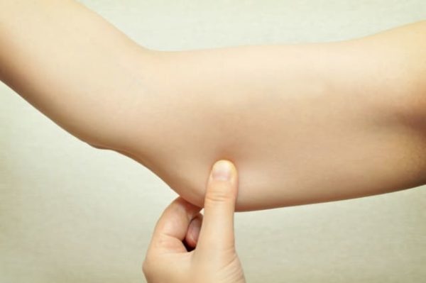 テニスボールで部分痩せ!太もも、ヒップ、脚、二の腕ダイエット