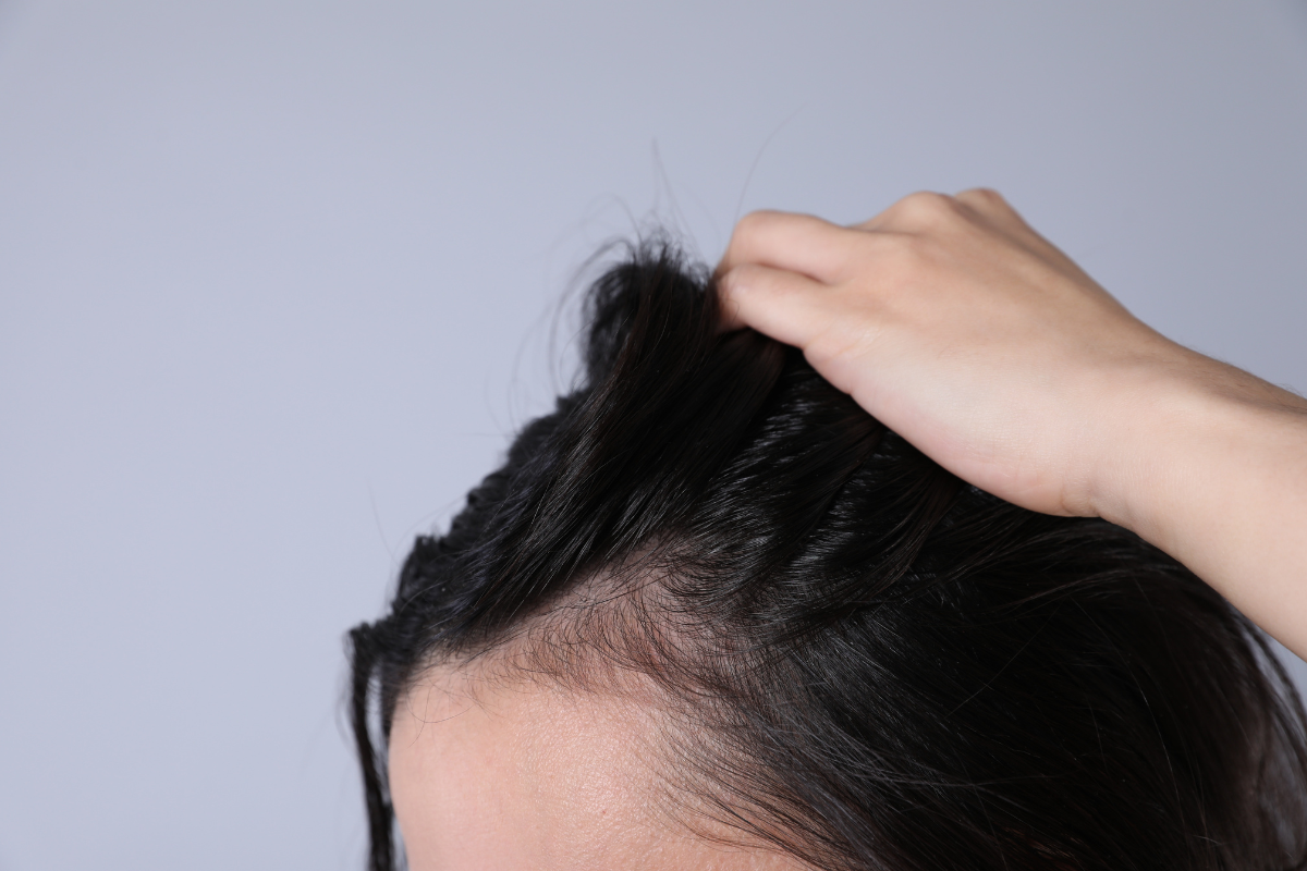 寒さが「顔のたるみ」と「抜け毛」を招く？今日からできる頭皮の冷え対策