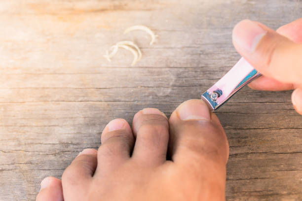 巻き爪の原因とは?知らないうちにやっているNG習慣5選