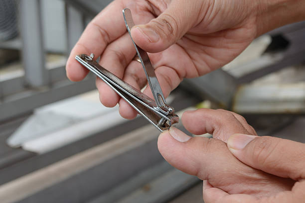 巻き爪、自分で切って悪化しました｜やりがちなNG行動と正しい対処法