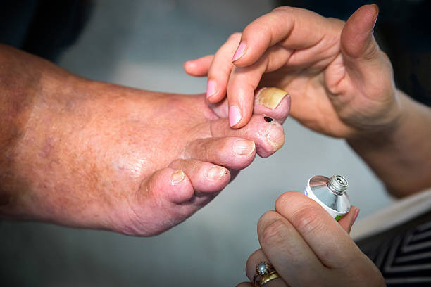 【八戸市】爪水虫の厚い爪は放置厳禁！薬が効かない原因をプロのフットケアで解決 