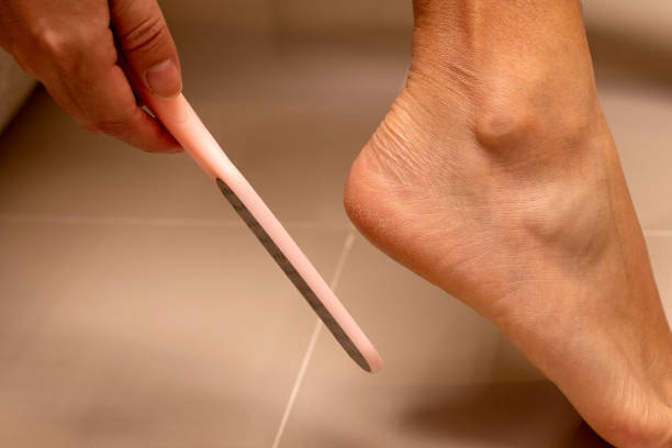 「削れば治る」は大間違い！ 魚の目だと思ってイボをいじると“大惨事”になる理由  