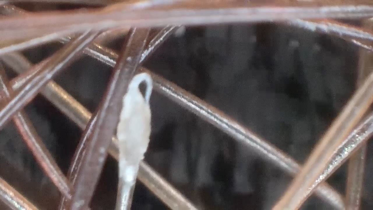 この髪の毛、正常な抜け毛?異常な抜け毛?