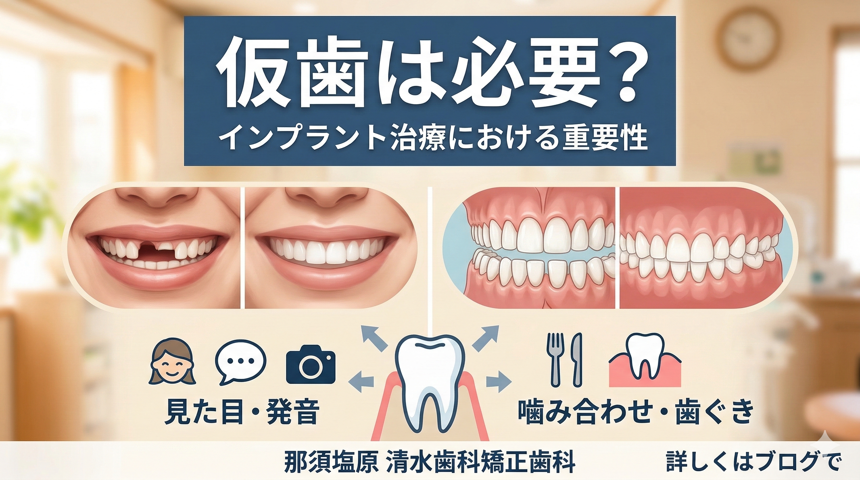 仮歯は必要?見た目・発音・生活のための仮歯の役割(インプラント編)|那須塩原