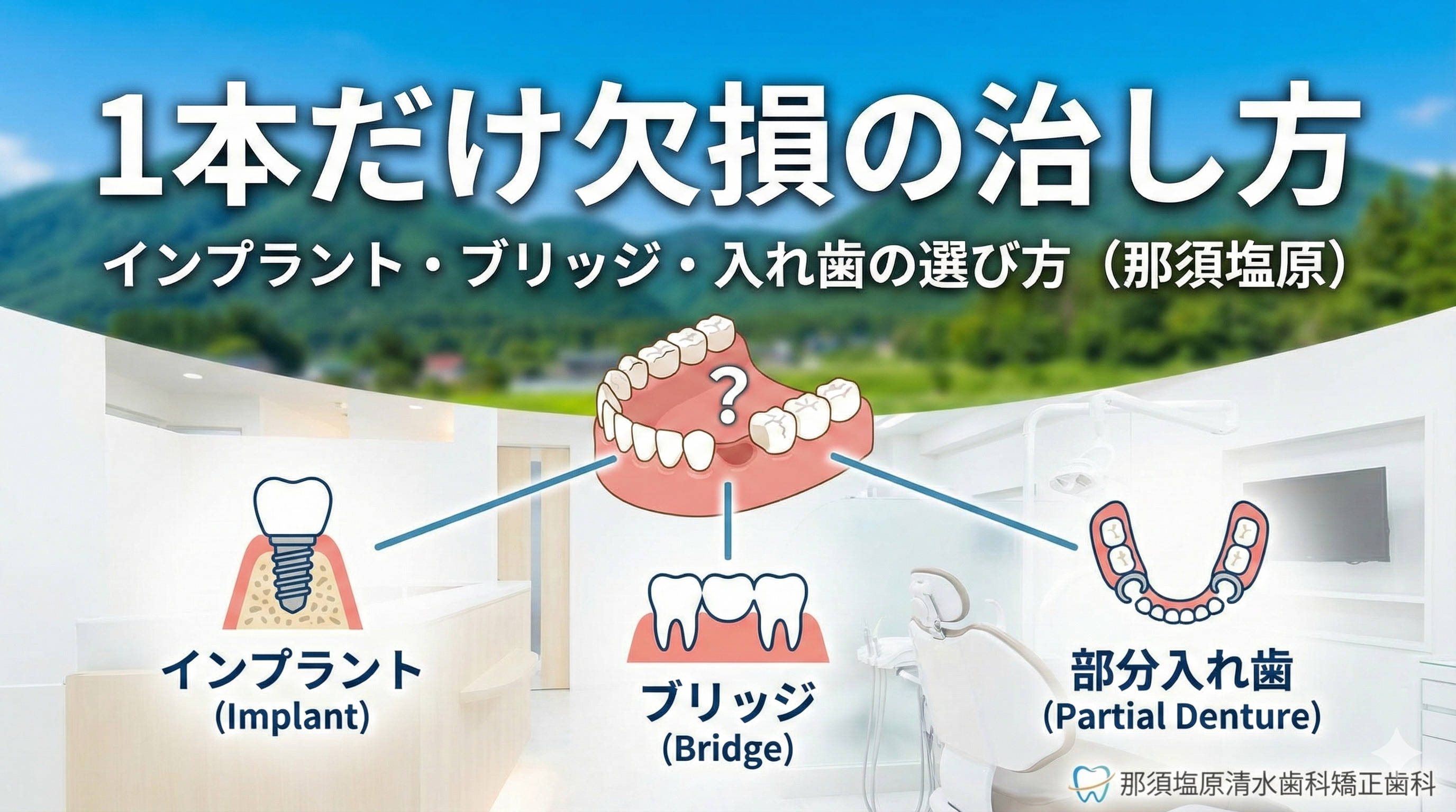 1本だけ欠損の治し方|インプラント・ブリッジ・入れ歯の選び方(那須塩原)