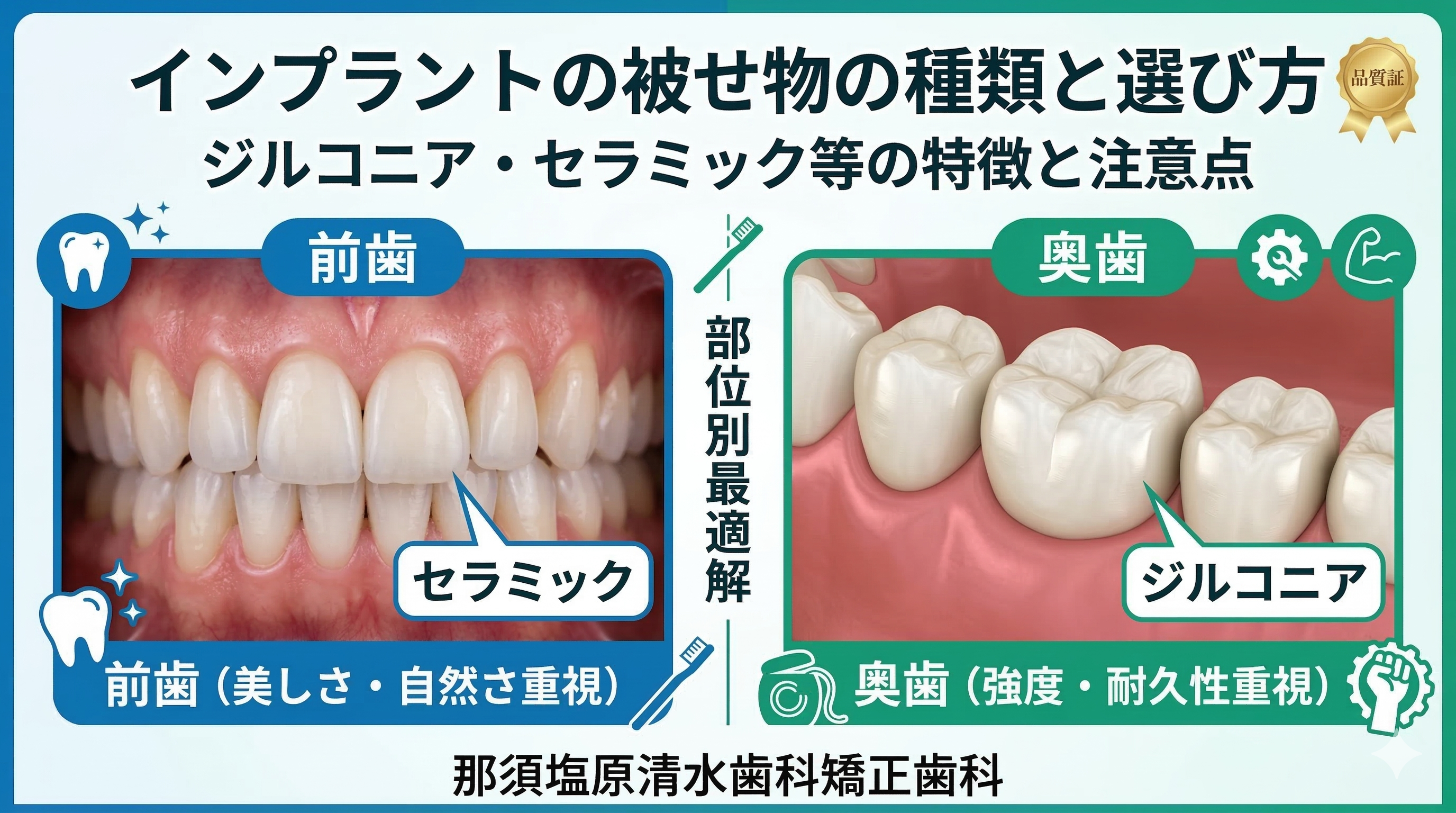 インプラントの被せ物の種類｜ジルコニア等の選び方と注意点（那須塩原）