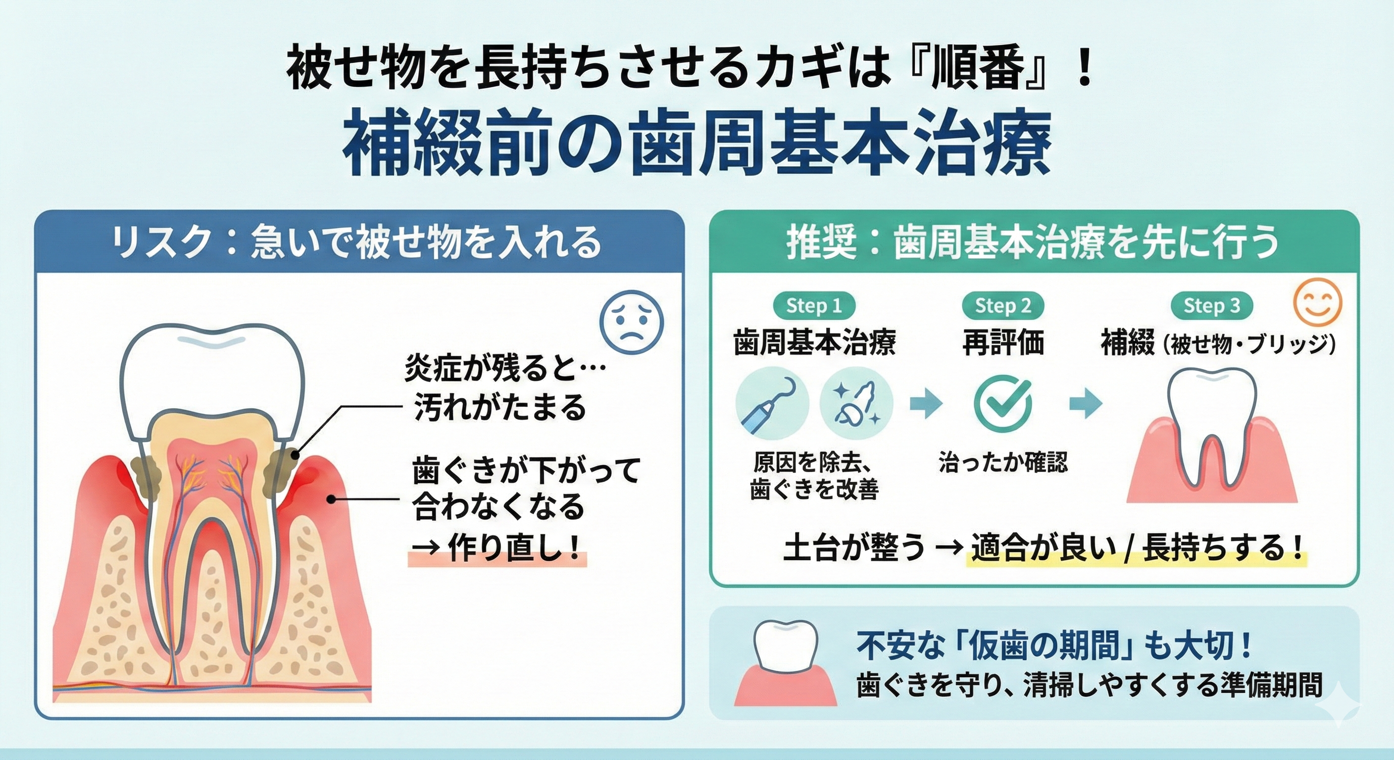 「先に被せ物」はNG?補綴前に歯周基本治療を行うべき理由と治療の流れ