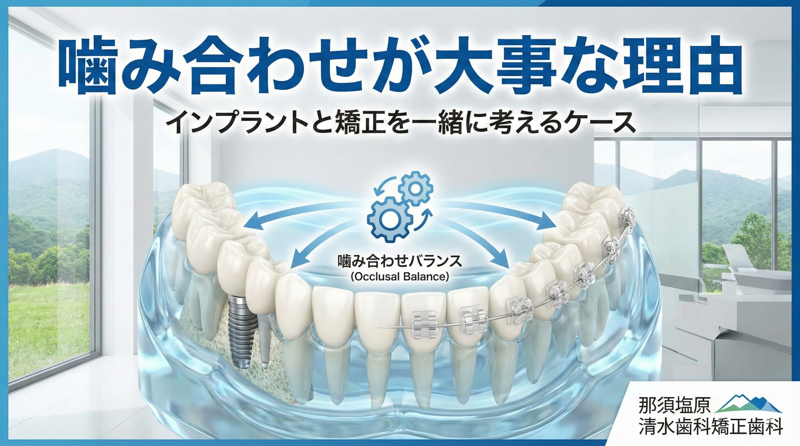 噛み合わせが大事な理由|インプラントと矯正を一緒に考えるケース(那須塩原)