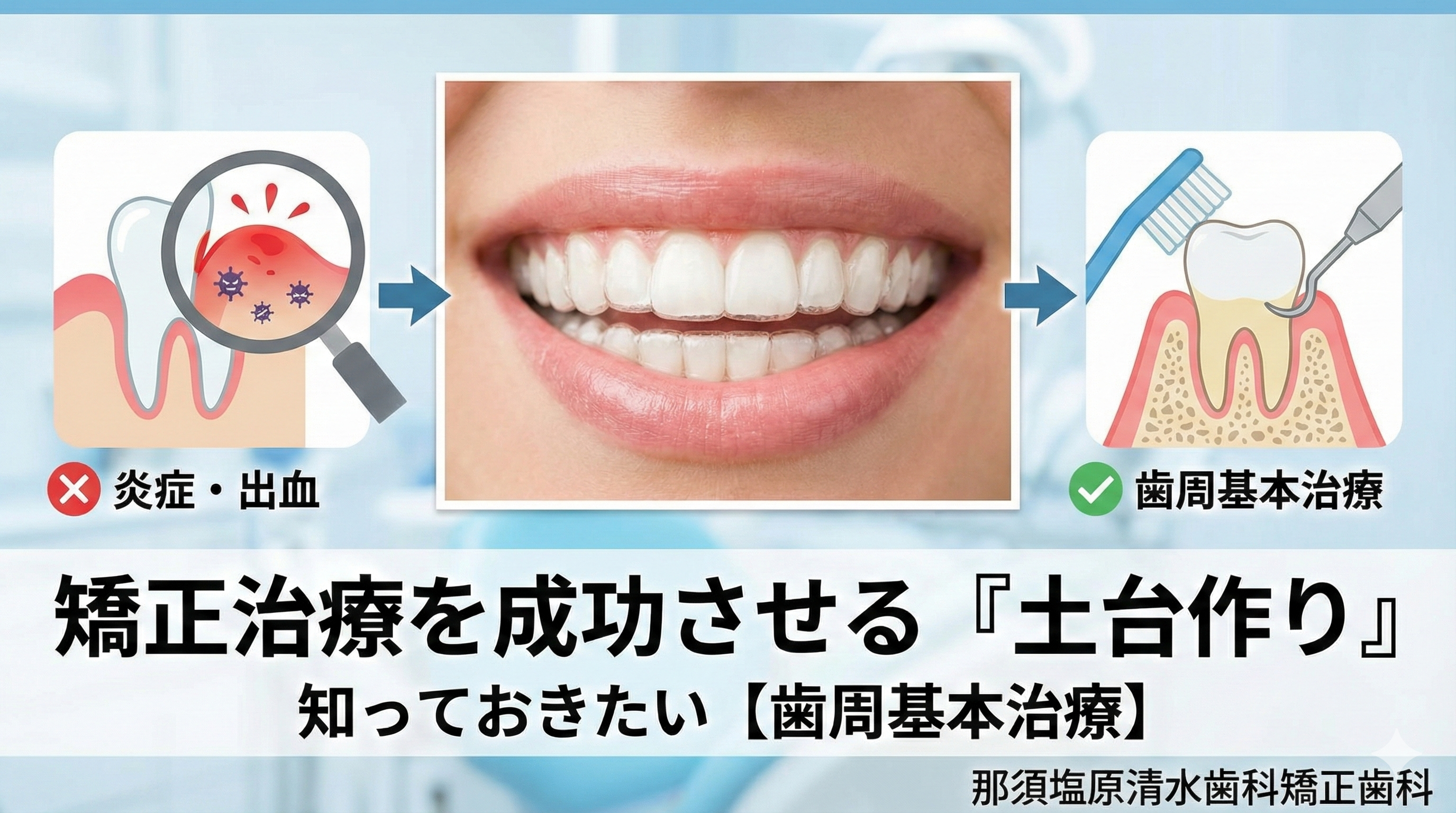 その歯ぐきのまま矯正を始めて大丈夫?後悔しないための歯周基本治療ガイド