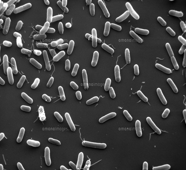 ヘモフィルス属のSEM
(c)David M. Phillips/Science Source